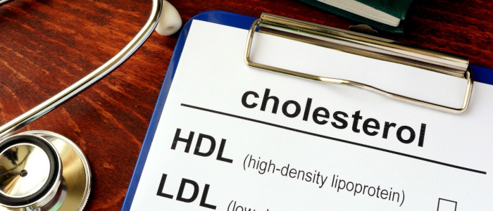 Panduan untuk Menurunkan Kolesterol Anda