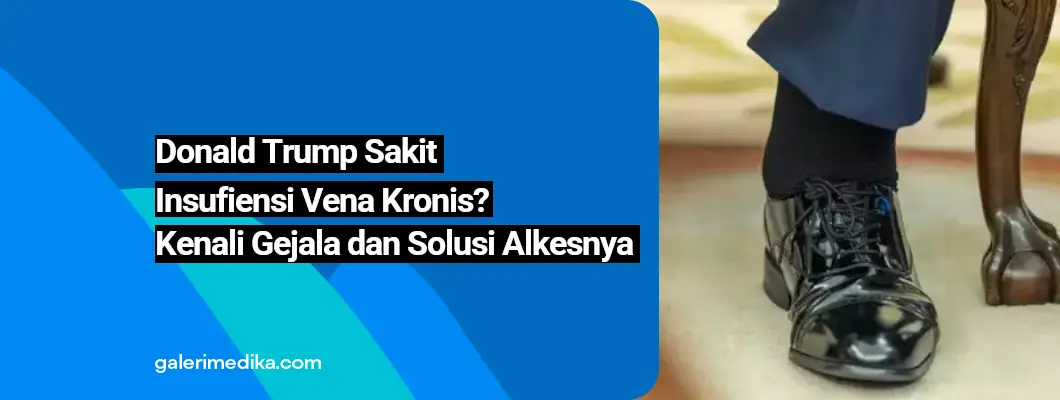 Donald Trump Sakit Insufiensi Vena Kronis? Kenali Gejala dan Solusi Alkesnya