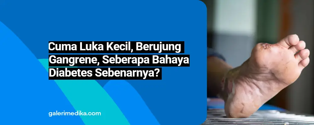 Cuma Luka Kecil, Berujung Gangren, Seberapa Berbahaya Diabetes Sebenarnya?