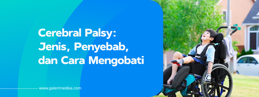 Cerebral Palsy: Jenis, Penyebab, dan Cara Mengobati