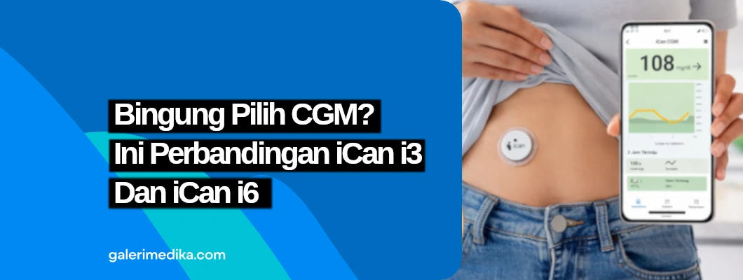 Bingung Pilih CGM? Ini Perbandingan iCan i3 Dan iCan i6