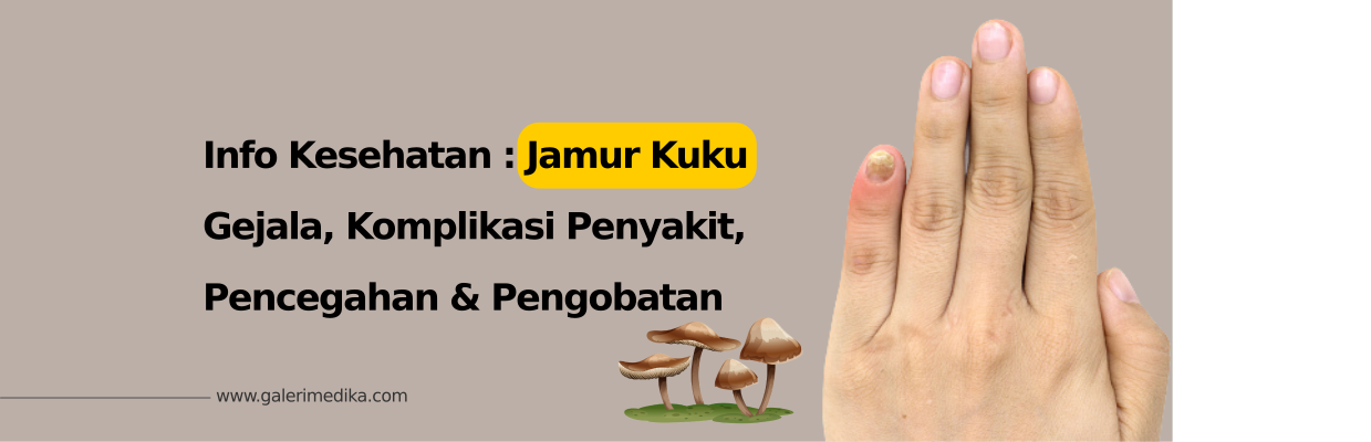 Jamur Kuku: Gejala, Komplikasi, Pencegahan dan Pengobatan