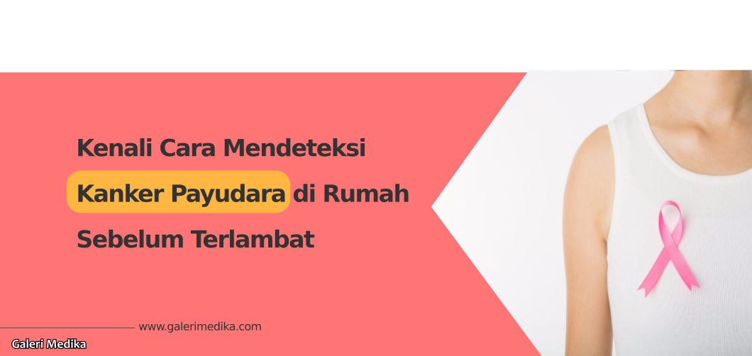 Kenali Cara Mendeteksi Kanker Payudara di Rumah Sebelum Terlambat