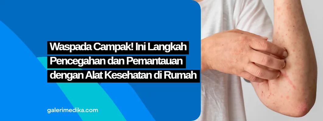 Waspada Campak! Ini Langkah Pencegahan dan Pemantauan dengan Alat Kesehatan di Rumah