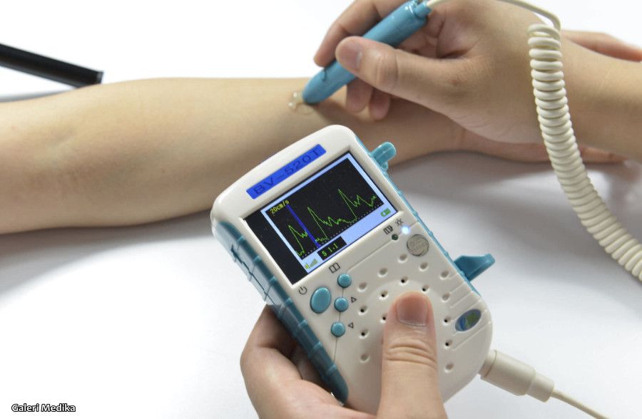 Cara Kerja Vascular Doppler, Alat Deteksi Sumbatan Aliran Darah