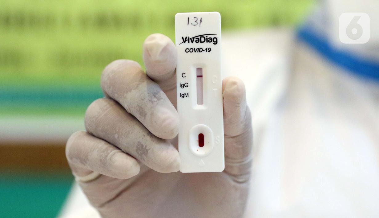 Memahami Cara Kerja Rapid Test Untuk Virus COVID-19