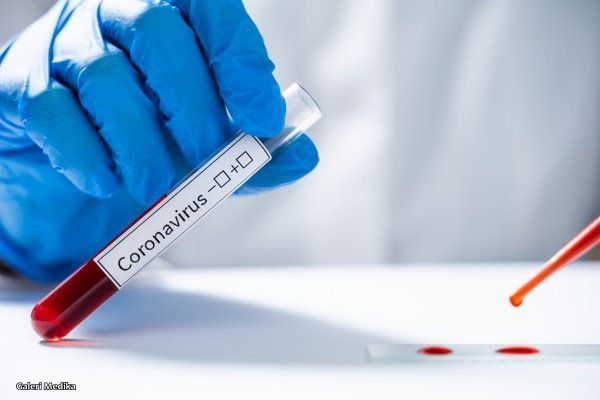 Rapid Tes Covid-19 Kurang Efektif, PCR Lebih Akurat