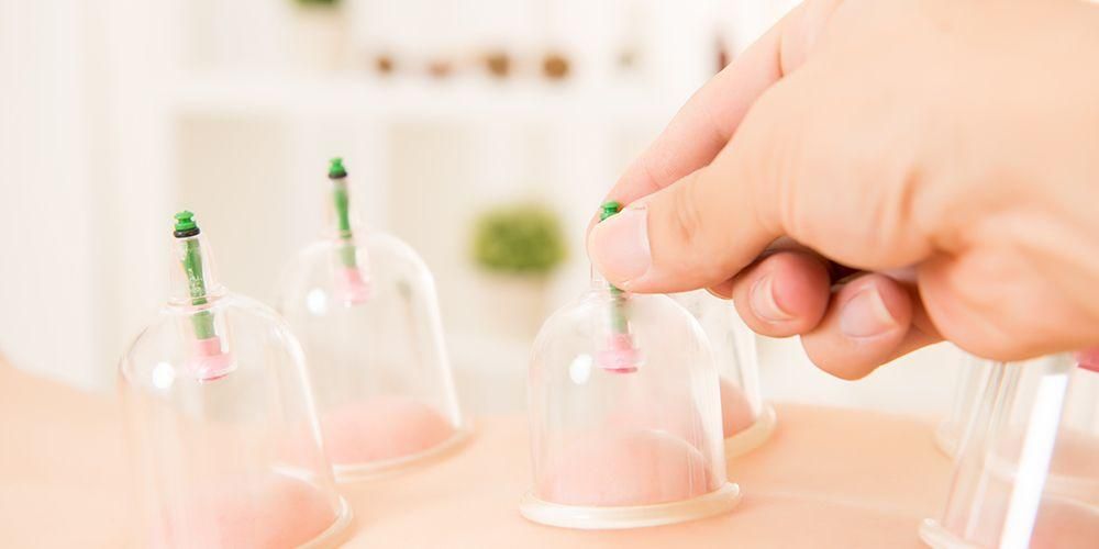 Bekam, Metode Penyembuhan Penyakit Yang Berasal Dari Timur Tengah