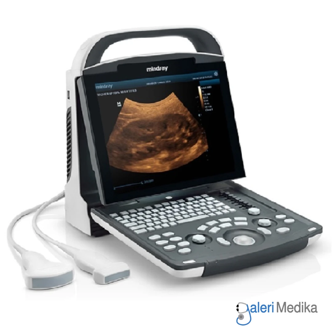 Mindray Alat USG 2D LED Screen 12.1" Digital Doppler Ultrasound System DP-10