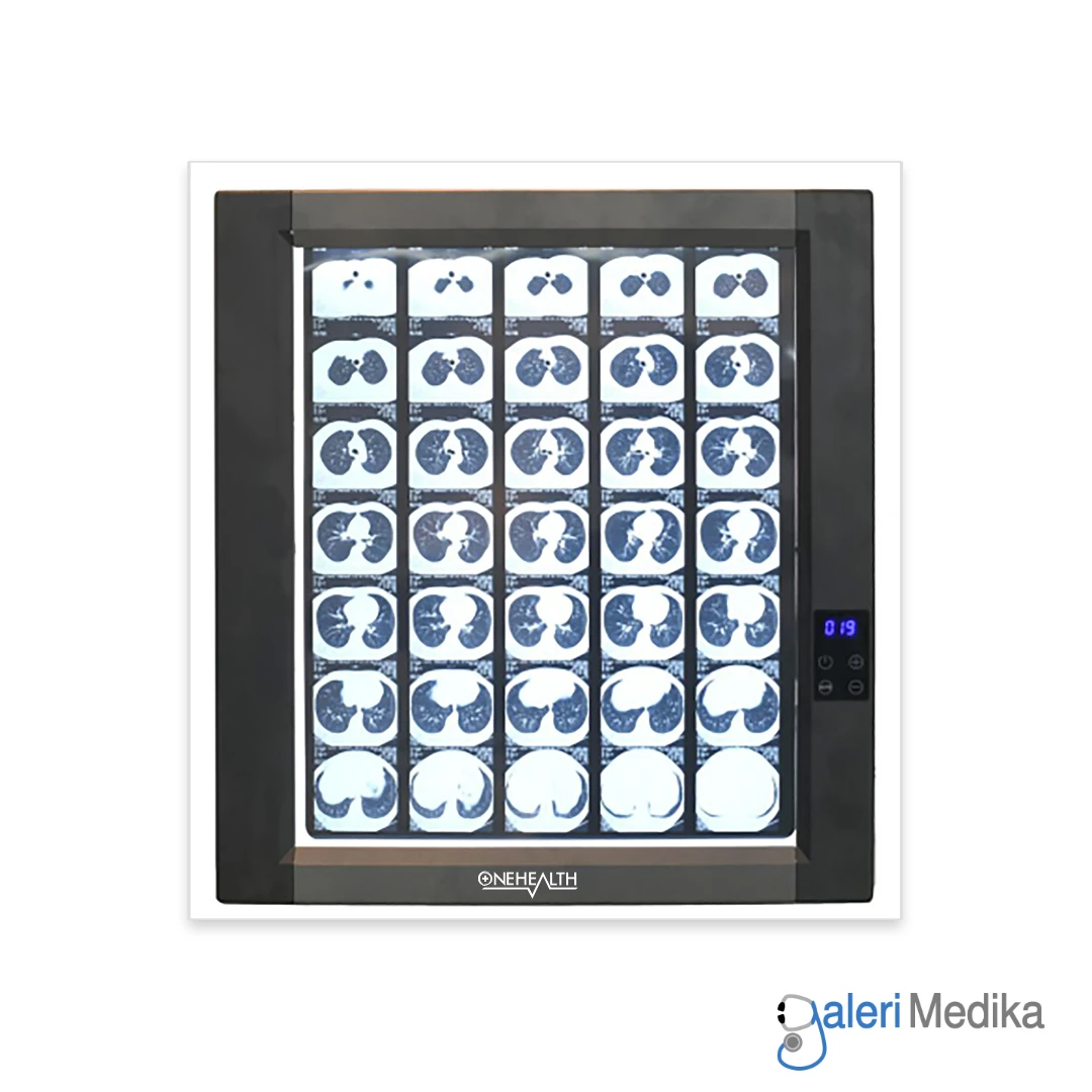 X-Ray Film Viewer OneHealth OH-VL-011 Single Slide Lampu LED Rontgen